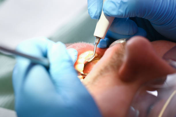 Best Same-Day Emergency Dental Services in Rogers, TX