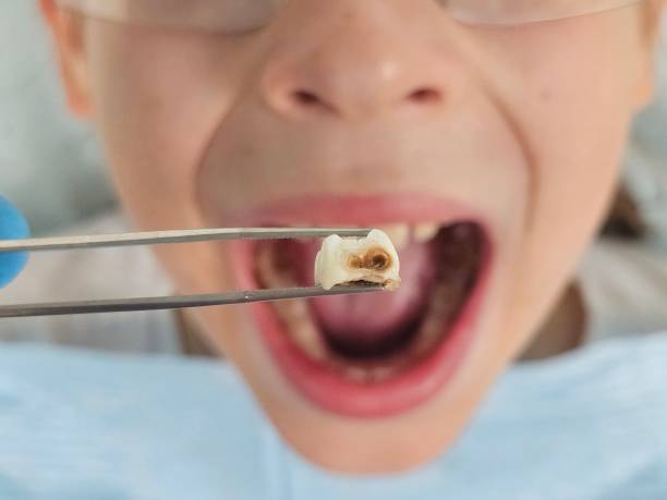Best Pediatric Emergency Dentist in Rogers, TX