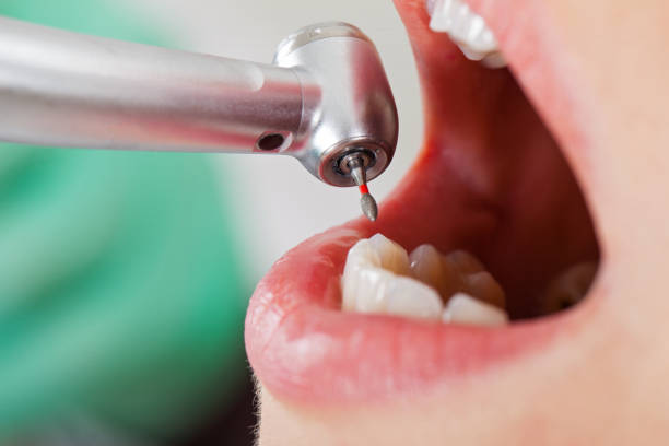 Best Emergency TMJ Treatment in Rogers, TX